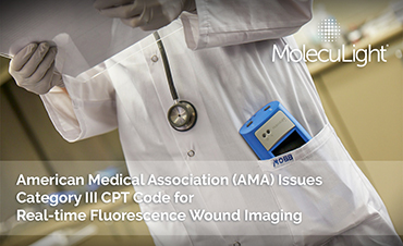AMA Issues Category III CPT Code for Real Time Fluorescence Wound Imaging