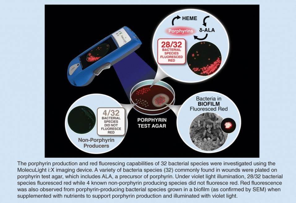 In Vitro Detection of Porphyrin | MolecuLight