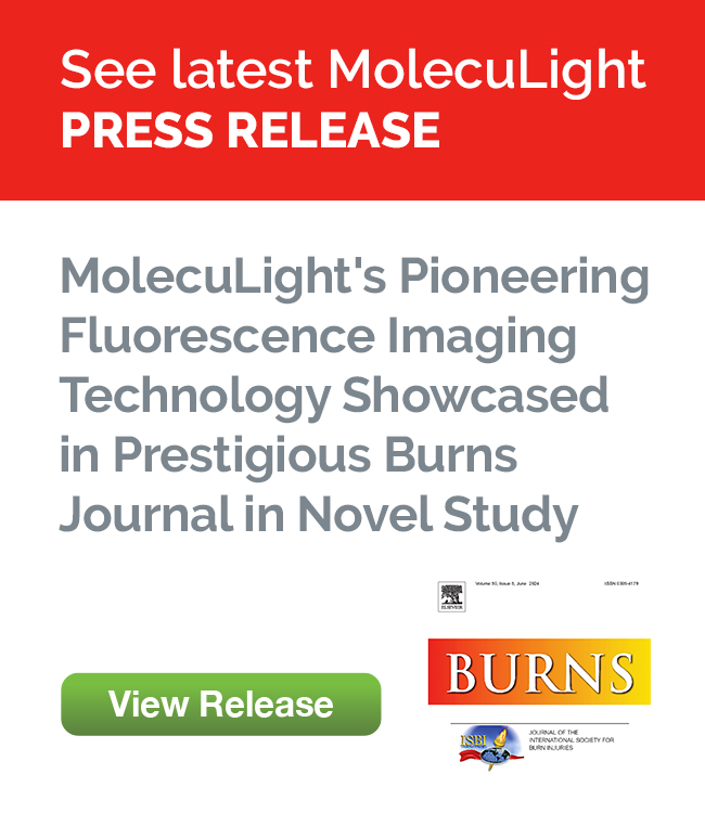 MolecuLight’s Pioneering Fluorescence Imaging Technology Showcased in Prestigious Burns Journal in Novel Study